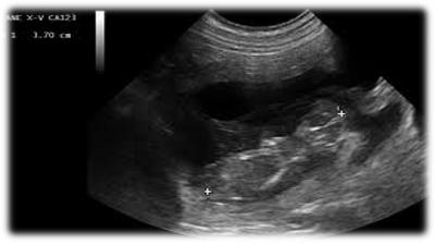 Ecografia di un feto di cane 